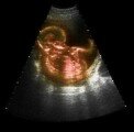 ultrasound-in-obstetrics-and-gynecology1