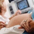 ultrasound-monitoring